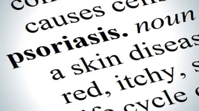 psoriasis news